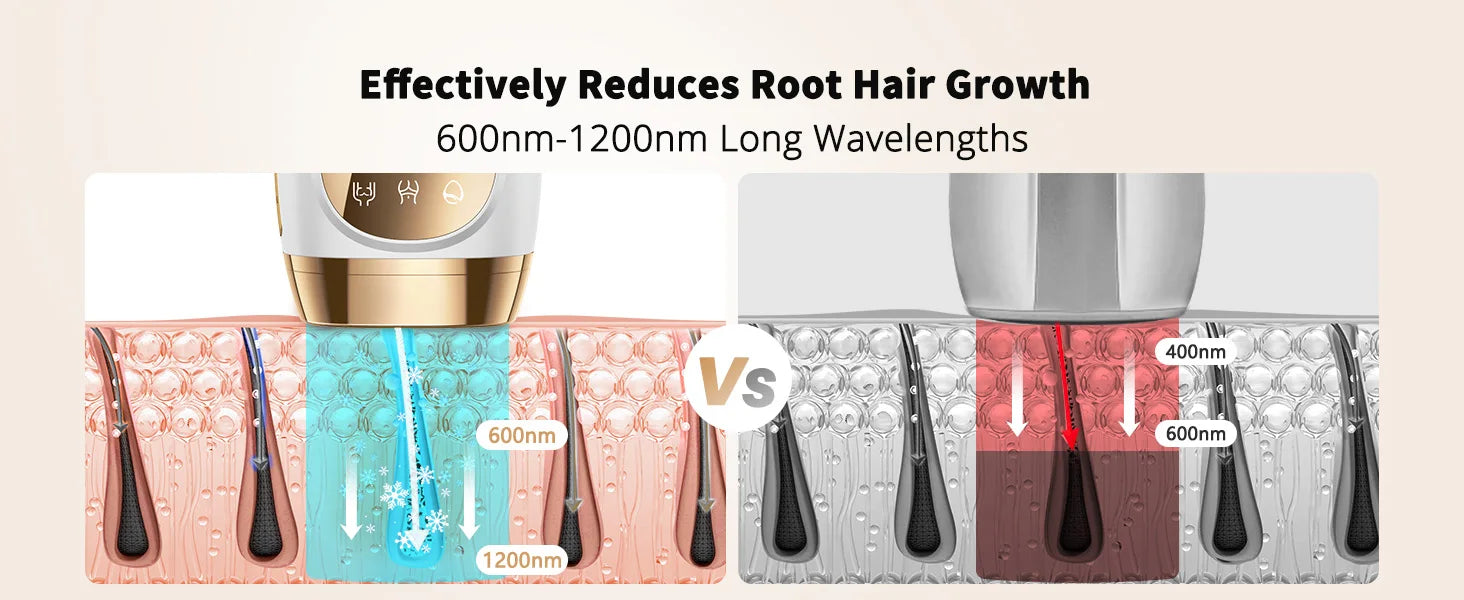 9-Level Ice-Cooling IPL Hair Remover – Painless, Permanent Smooth Skin at Home