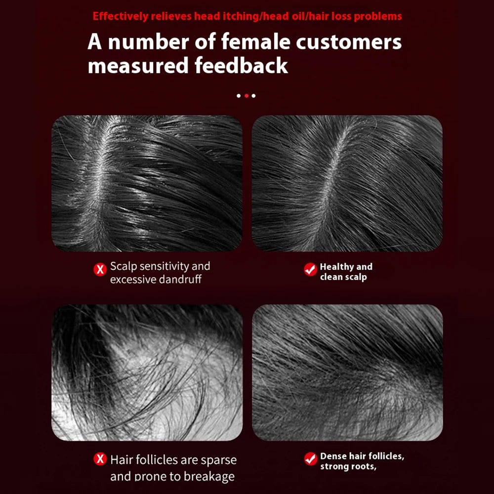 Electric Scalp Massager with Red Light Therapy – Hair Growth & Relaxation Comb