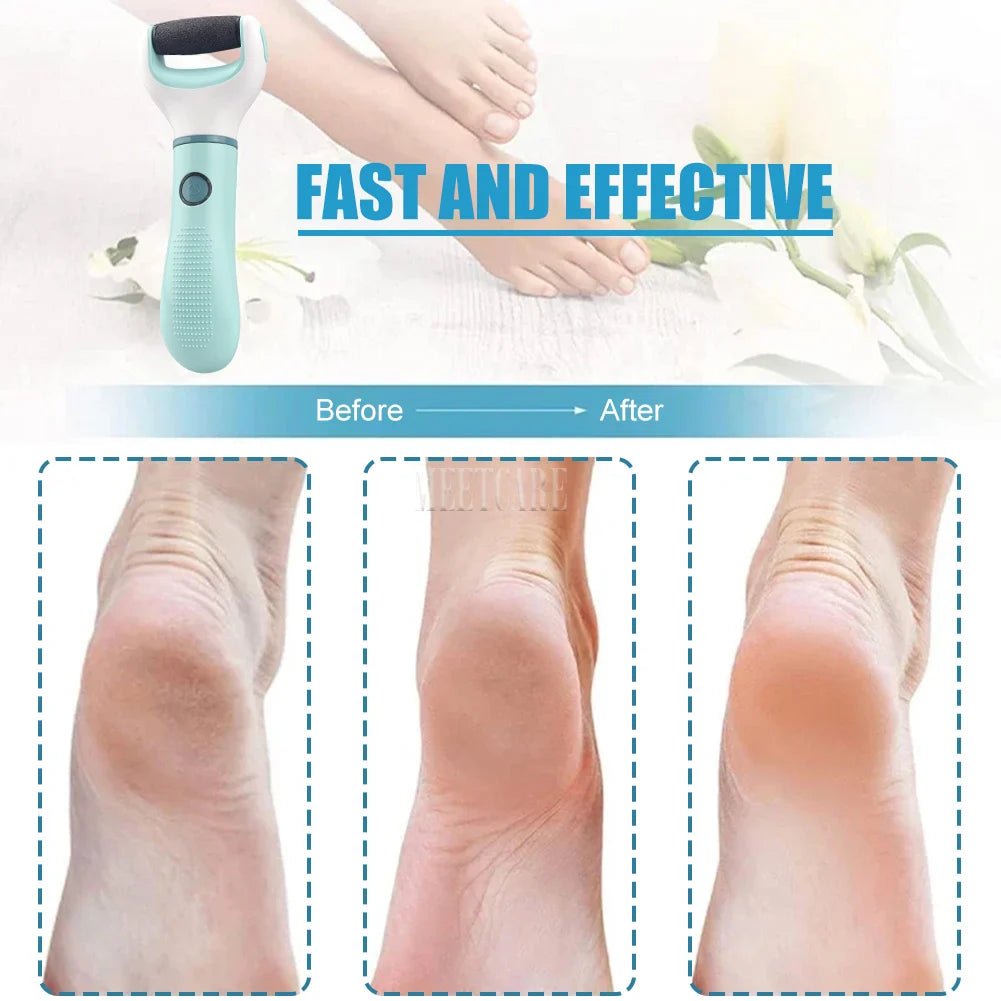 Waterproof Electric Foot Cleaner – Heal Cracks & Restore Baby-Soft Skin