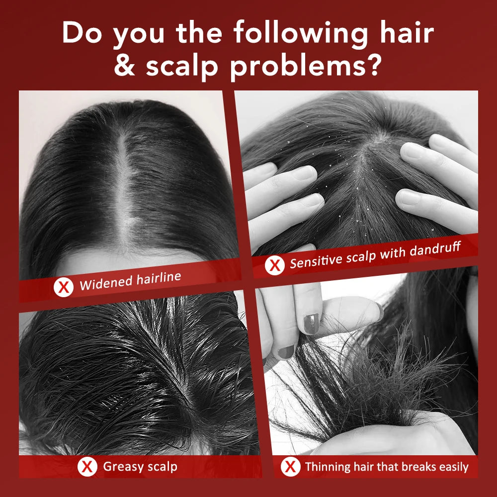 Electric Scalp Massager with Red Light Therapy – Hair Growth & Relaxation Comb