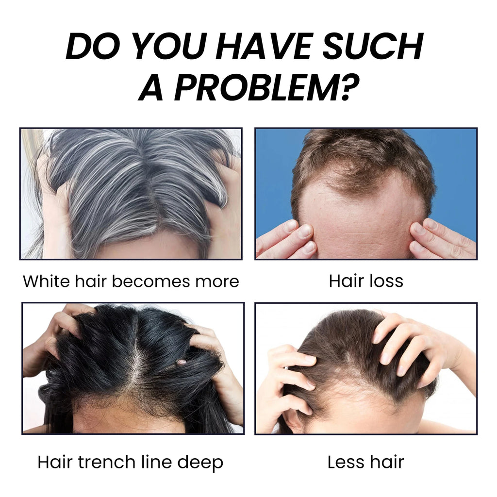 Charcoal Hair Soap – Restore Natural Colour, Strengthen & Nourish Hair