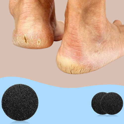 Callus and Crack Remover